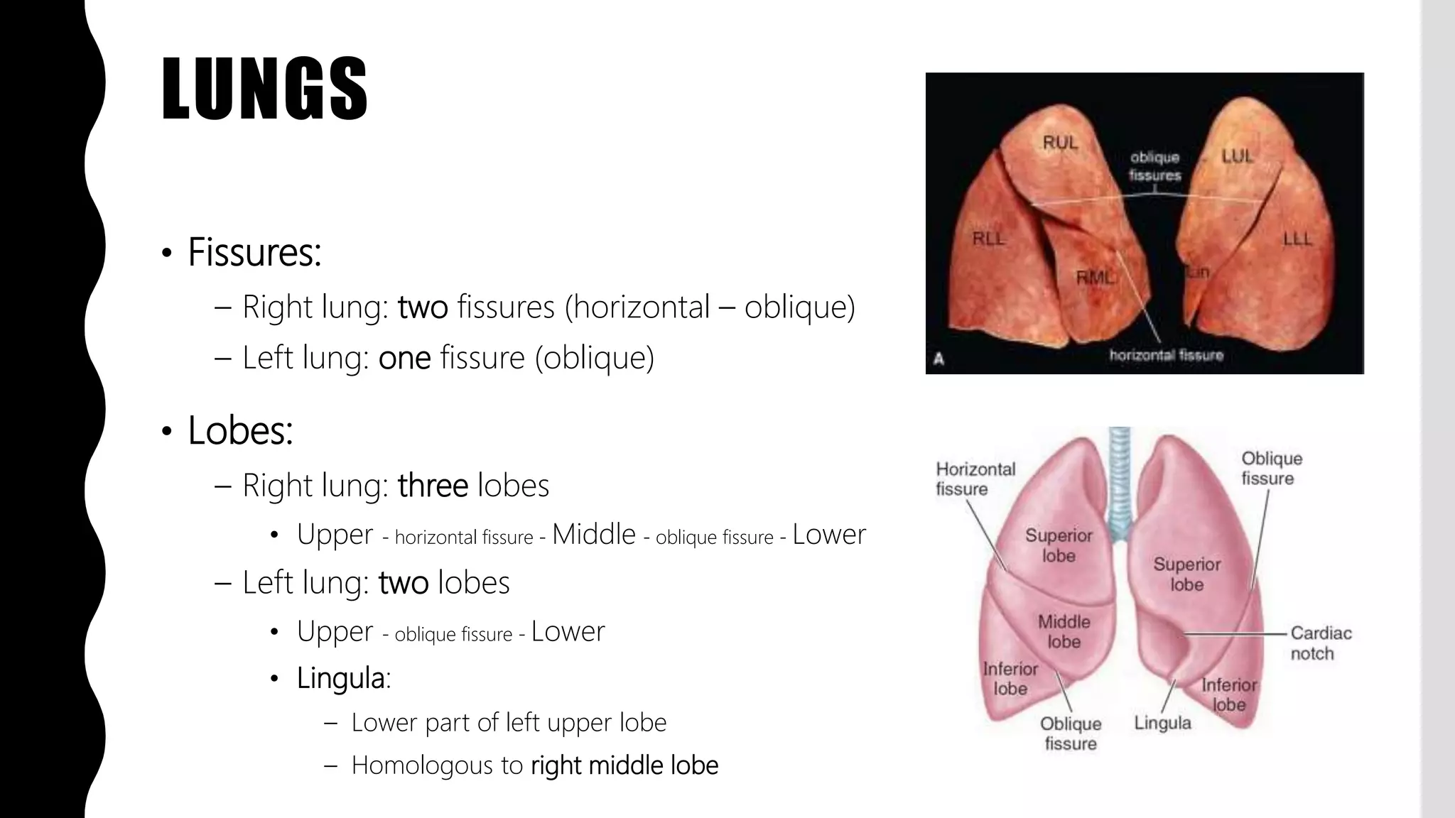 FlashPath - Lung - Anatomy | PPTX