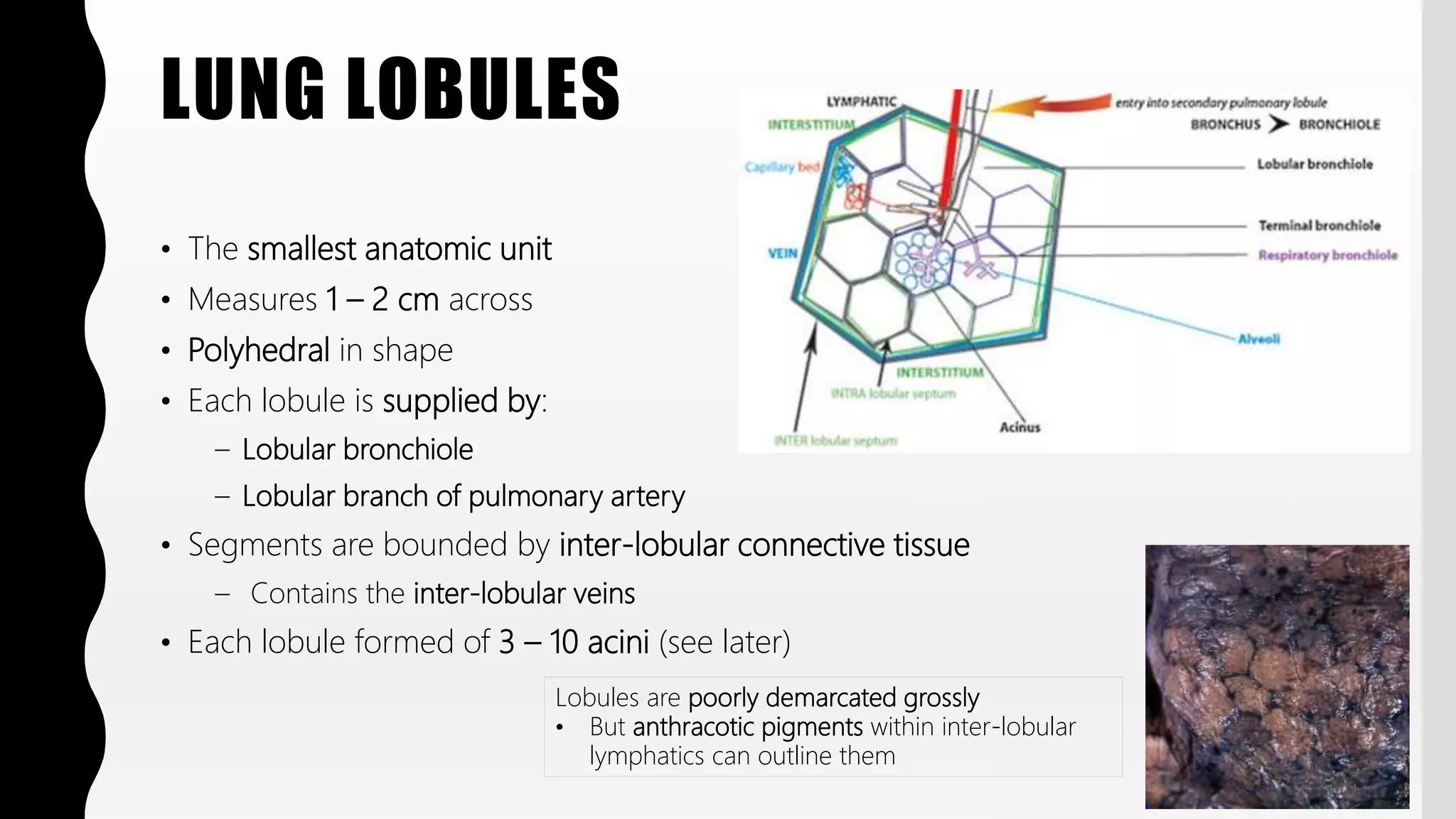 FlashPath - Lung - Anatomy | PPTX