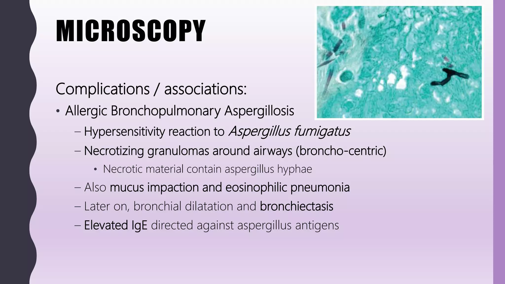 MICROSCOPY
Complications / associations:
• Allergic Bronchopulmonary Aspergillosis
– Hypersensitivity reaction to Aspergillus fumigatus
– Necrotizing granulomas around airways (broncho-centric)
• Necrotic material contain aspergillus hyphae
– Also mucus impaction and eosinophilic pneumonia
– Later on, bronchial dilatation and bronchiectasis
– Elevated IgE directed against aspergillus antigens
 
