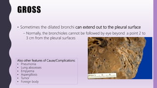 FlashPath - Lung - Bronchiectasis | PPT