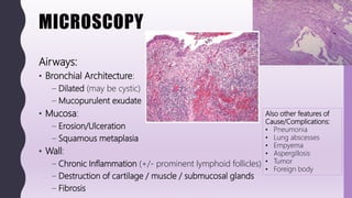 FlashPath - Lung - Bronchiectasis | PPT