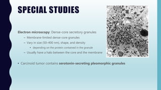SPECIAL STUDIES
Electron microscopy: Dense-core secretory granules
– Membrane-limited dense-core granules
– Vary in size (50–400 nm), shape, and density
• depending on the protein contained in the granule
– Usually have a halo between the core and the membrane
• Carcinoid tumor contains serotonin-secreting pleomorphic granules
 