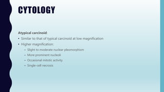 CYTOLOGY
Atypical carcinoid:
• Similar to that of typical carcinoid at low magnification
• Higher magnification:
– Slight to moderate nuclear pleomorphism
– More prominent nucleoli
– Occasional mitotic activity
– Single-cell necrosis
 