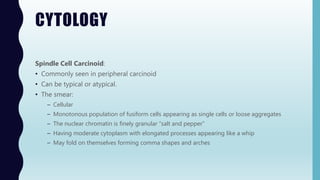 CYTOLOGY
Spindle Cell Carcinoid:
• Commonly seen in peripheral carcinoid
• Can be typical or atypical.
• The smear:
– Cellular
– Monotonous population of fusiform cells appearing as single cells or loose aggregates
– The nuclear chromatin is finely granular “salt and pepper”
– Having moderate cytoplasm with elongated processes appearing like a whip
– May fold on themselves forming comma shapes and arches
 