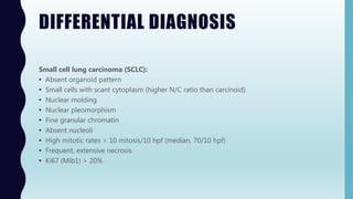 DIFFERENTIAL DIAGNOSIS
Small cell lung carcinoma (SCLC):
• Absent organoid pattern
• Small cells with scant cytoplasm (higher N/C ratio than carcinoid)
• Nuclear molding
• Nuclear pleomorphism
• Fine granular chromatin
• Absent nucleoli
• High mitotic rates > 10 mitosis/10 hpf (median, 70/10 hpf)
• Frequent, extensive necrosis
• Ki67 (Mib1) > 20%
 