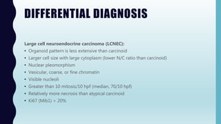 DIFFERENTIAL DIAGNOSIS
Large cell neuroendocrine carcinoma (LCNEC):
• Organoid pattern is less extensive than carcinoid
• Larger cell size with large cytoplasm (lower N/C ratio than carcinoid)
• Nuclear pleomorphism
• Vesicular, coarse, or fine chromatin
• Visible nucleoli
• Greater than 10 mitosis/10 hpf (median, 70/10 hpf)
• Relatively more necrosis than atypical carcinoid
• Ki67 (Mib1) > 20%
 