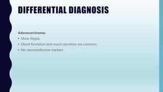 DIFFERENTIAL DIAGNOSIS
Adenocarcinoma:
• More Atypia
• Gland formation and mucin secretion are common
• No neuroendocrine markers
 