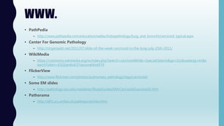 WWW.
• PathPedia
– http://www.pathpedia.com/education/eatlas/histopathology/lung_and_bronchi/carcinoid_typical.aspx
• Center For Genomic Pathology
– http://ctrgenpath.net/2011/07/slide-of-the-week-carcinoid-in-the-lung-july-25th-2011/
• WikiMedia
– https://commons.wikimedia.org/w/index.php?search=carcinoid&title=Special:Search&go=Go&uselang=en&s
earchToken=42t2jqm6ok37vpnunahkve974
• FlickerView
– http://www.flickriver.com/photos/pulmonary_pathology/tags/carcinoid/
• Some EM slides
– http://pathology.osu.edu/residents/StudyGuides/EM/Carcinoid/carcinoid1.htm
• Pathorama
– http://alf3.urz.unibas.ch/pathopic/e/intro.htm
 
