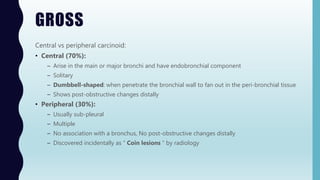 GROSS
Central vs peripheral carcinoid:
• Central (70%):
– Arise in the main or major bronchi and have endobronchial component
– Solitary
– Dumbbell-shaped: when penetrate the bronchial wall to fan out in the peri-bronchial tissue
– Shows post-obstructive changes distally
• Peripheral (30%):
– Usually sub-pleural
– Multiple
– No association with a bronchus, No post-obstructive changes distally
– Discovered incidentally as “ Coin lesions “ by radiology
 