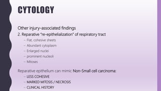 CYTOLOGY
Other injury-associated findings
2. Reparative “re-epithelialization” of respiratory tract
– Flat, cohesive sheets
– Abundant cytoplasm
– Enlarged nuclei
– prominent nucleoli
– Mitoses
Reparative epithelium can mimic Non-Small cell carcinoma:
– LESS COHESIVE
– MARKED MITOSIS / NECROSIS
– CLINICAL HISTORY
 