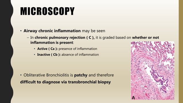 FlashPath- Lung - Constrictive (Obliterative) Bronchiolitis | PPT