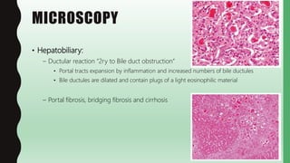 FlashPath - Cystic Fibrosis | PPTX