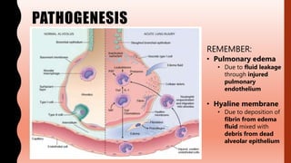 PATHOGENESIS
REMEMBER:
• Pulmonary edema
• Due to fluid leakage
through injured
pulmonary
endothelium
• Hyaline membrane
• Due to deposition of
fibrin from edema
fluid mixed with
debris from dead
alveolar epithelium
 