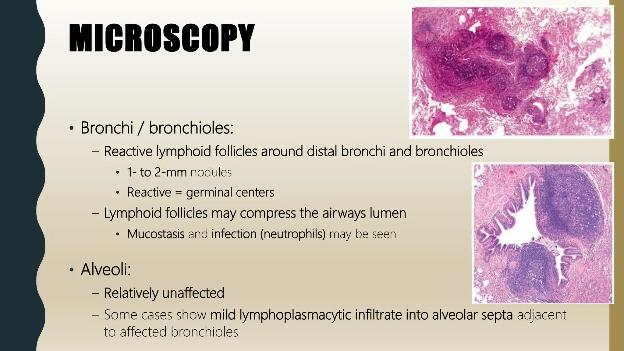 FlashPath - Lung - Follicular Bronchitis / Bronchiolitis | PPTX | Lung ...