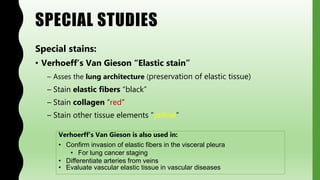 SPECIAL STUDIES
Special stains:
• Verhoeff’s Van Gieson “Elastic stain”
– Asses the lung architecture (preservation of elastic tissue)
– Stain elastic fibers “black”
– Stain collagen “red”
– Stain other tissue elements “yellow”
Verhoerff’s Van Gieson is also used in:
• Confirm invasion of elastic fibers in the visceral pleura
• For lung cancer staging
• Differentiate arteries from veins
• Evaluate vascular elastic tissue in vascular diseases
 