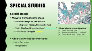 SPECIAL STUDIES
Special stains:
• Movat’s Pentachrome stain
– Asses the stage of the disease
• (degree of fibrosis/fibroblastic foci)
– Stain fibroblastic proliferation “blue-green“
– Stain dense collagen “yellow“
• Also Stains to exclude infections:
– Acid fast stains
– Fungal stains
Movat’s Pentachrome also stains:
• Elastic laminae “ black “
• Smooth muscle fibers “ dull red “
• Fibrinoid necrosis “ bright red “
 