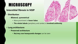 MICROSCOPY
Interstitial fibrosis in NSIP
• Distribution:
– Bilateral, symmetrical
• More prominent in lower lobes
• The whole lobule (periphery and center) is involved uniformly
• Lung architecture:
– Preserved architecture
• No/very rare honeycomb changes can be seen
 