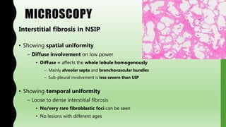 MICROSCOPY
Interstitial fibrosis in NSIP
• Showing spatial uniformity
– Diffuse involvement on low power
• Diffuse = affects the whole lobule homogenously
– Mainly alveolar septa and bronchovascular bundles
– Sub-pleural involvement is less severe than UIP
• Showing temporal uniformity
– Loose to dense interstitial fibrosis
• No/very rare fibroblastic foci can be seen
• No lesions with different ages
 