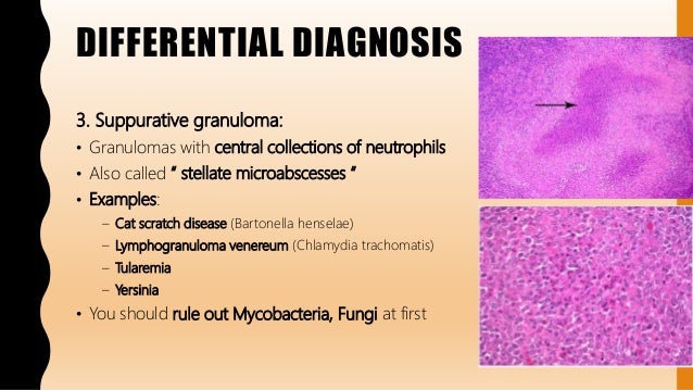 Cat Scratch Disease Differential Diagnosis Cat Scratch Disease Differential Diagnosis