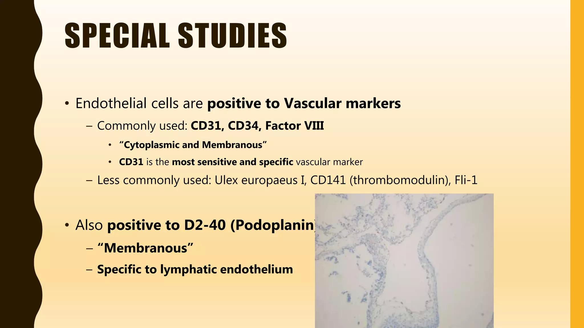 FlashPath - Lung - Pulmonary Lymphangiectasis | PPTX