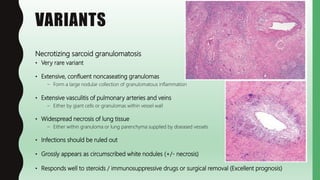 Noncaseating Necrosis FlashPath - Sarcoidosis | PPTX