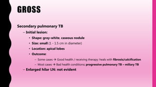 GROSS
Secondary pulmonary TB
– Initial lesion:
• Shape: gray-white, caseous nodule
• Size: small (1 - 1.5 cm in diameter)
• Location: apical lobes
• Outcome:
– Some cases  Good health / receiving therapy: heals with fibrosis/calcification
– Most cases  Bad health conditions: progressive pulmonary TB – miliary TB
– Enlarged hilar LN: not evident
 
