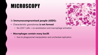 MICROSCOPY
In Immunocompromised people (AIDS):
• Characteristic granulomas is not formed
• No CD4 T cells = no sensitization and macrophage activation
• Macrophages contain many bacilli
• Due to phagosomal manipulation and unchecked replication
 