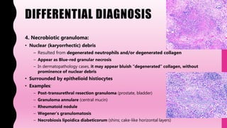 DIFFERENTIAL DIAGNOSIS
4. Necrobiotic granuloma:
• Nuclear (karyorrhectic) debris
– Resulted from degenerated neutrophils and/or degenerated collagen
– Appear as Blue-red granular necrosis
– In dermatopathology cases, it may appear bluish “degenerated” collagen, without
prominence of nuclear debris
• Surrounded by epithelioid histiocytes
• Examples:
– Post-transurethral resection granuloma (prostate, bladder)
– Granuloma annulare (central mucin)
– Rheumatoid nodule
– Wegener’s granulomatosis
– Necrobiosis lipoidica diabeticorum (shins; cake-like horizontal layers)
 