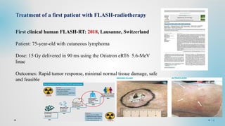 FLASH Radiotherapy , hot topic in medical physics | PPTX