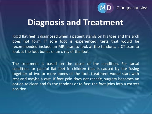 flat foot syndrome