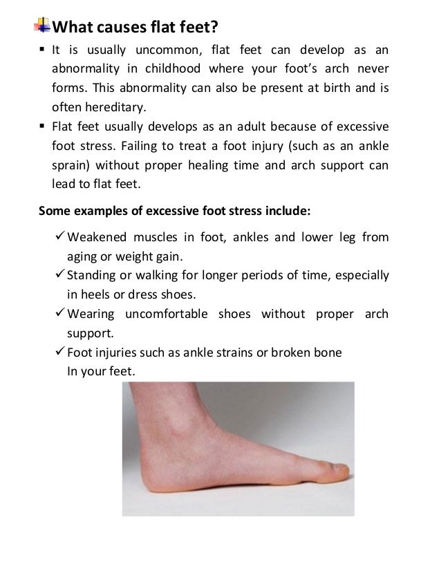 Flat feet causes symptoms treatment