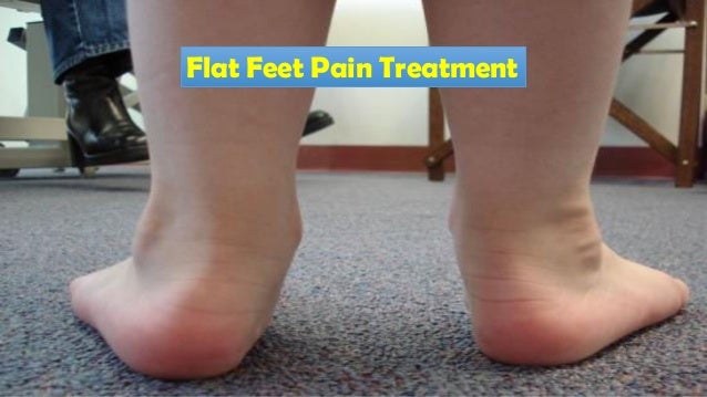 Flat feet pain treatment