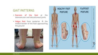 clinical examination of flat foot | PDF