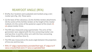 clinical examination of flat foot | PDF