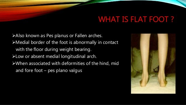 what is flat foot shifting what is flat foot shifting