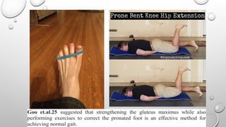 Goo et.al.25 suggested that strengthening the gluteus maximus while also
performing exercises to correct the pronated foot is an effective method for
achieving normal gait.
 