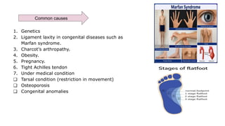 1. Genetics
2. Ligament laxity in congenital diseases such as
Marfan syndrome.
3. Charcot's arthropathy.
4. Obesity.
5. Pregnancy.
6. Tight Achilles tendon
7. Under medical condition
❏ Tarsal condition (restriction in movement)
❏ Osteoporosis
❏ Congenital anomalies
Common causes
 