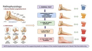 Pathophysiology
1.Normal Medial Longitudinal Arch
2. Soft tissues
1. NORMAL FOOT
2.WEAKNESS/INJURY/
LIGAMENT
LAXITY/TENDON
DYSFUNCTION
3. LOSS OF ARCH
SUPPORT
4. COLLAPSE OF
MEDIAL ARCH
5. FLAT FOOT (PES
PLANUS)
NOTE:Dysfunction/Injury to any of the supporting leads to collapse of the medial longitudinal arch, Result: Flat foot deformity
 