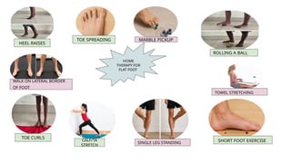 HOME
THERAPY FOR
FLAT FOOT
CALF/TA
STRETCH
MARBLE PICKUP
HEEL RAISES
TOE CURLS
SHORT FOOT EXERCISE
TOE SPREADING
ROLLING A BALL
SINGLE LEG STANDING
TOWEL STRETCHING
WALK ON LATERAL BORDER
OF FOOT
 