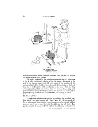 824                                                                       ERNST               BETTMANN




                                                                                        FIG.         5
                                                                          The       turbine               wheel:
                                                                                 a: grasping                   exercises
                                                                                 b: adduction                    exercises.


an       adjustable             plate,      which       fixes                                    and             mobilizes                         them,               so      that        the          patient
can        apply         the treatment           himself.
           The          results    obtained         by the                                       use           of this                apparatus                        are      : (1)        stretching
of the   Achilles                         tendon                   and            pointing                      of     the    calcaneum                               ; (2) raising                       of         the
arch   in the                         talonavicular                               joint;                 (3)         conversion         of                           the   position                       of          the
metatarsal                     part           of        the        foot          into          pronation                        ; and              (4)      shortening                      of      the        front
from            toe       to      heel             together                      with           mobilization              of         the       toes.             With            the        help
of this               apparatus,                    which               can  be used         from                                  two   to three                             times      daily                 for      a
period                of from                 twenty                  to thirty        minutes,                                     the   author                             has     succeeded                         in
preparing                  many                stiffened                 and   painful       feet                                for the     wearing                              of arches.

 The        Turbine                   Wheel
           To         make             foot             calisthenics                     attractive                            for         children,                   the       so-called                “tur-
bine         wheel”                   has           been             constructed.                    (See            Figure                   5.)               By           means    of   dif-
ferent            adjustments                      it    permits                  the          corrective                        exercise                  of     practically                     all     foot
muscles,                 and           it      can            be          used          for          both             the             right              and           the        left       foot.                   Two
parallel               wooden                 disks,               covered                    with              rubber,                    about                twenty                centimeters                      in

                                                                                               THE             JOURNAL                 OF      BONE              AND         JOINT         SURGERY
 