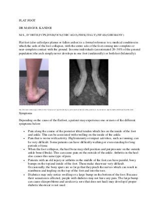 FLAT FOOT

DR MANOJ R. KANDOI

M.S., D’ORTH,FCPS,DNB,FICS(CHICAGO),FIHS(ITALY),FIFAS(GERMANY)

Flat feet (also called pes planus or fallen arches) is a formal reference to a medical condition in
which the arch of the foot collapses, with the entire sole of the foot coming into complete or
near-complete contact with the ground. In some individuals (an estimated 20–30% of the general
population) the arch simply never develops in one foot (unilaterally) or both feet (bilaterally).




One of the more common signs of flatfoot is the "too many toes" sign. Even the big toe can be seen from the back of this patient's foot. In a normal foot, only the fourth and fifth toes should be visible.

Symptoms

Depending on the cause of the flatfoot, a patient may experience one or more of the different
symptoms below:

               Pain along the course of the posterior tibial tendon which lies on the inside of the foot
                and ankle. This can be associated with swelling on the inside of the ankle.
               Pain that is worse with activity. High intensity or impact activities, such as running, can
                be very difficult. Some patients can have difficulty walking or even standing for long
                periods of time.
               When the foot collapses, the heel bone may shift position and put pressure on the outside
                ankle bone (fibula). This can cause pain on the outside of the ankle. Arthritis in the heel
                also causes this same type of pain.
               Patients with an old injury or arthritis in the middle of the foot can have painful, bony
                bumps on the top and inside of the foot. These make shoewear very difficult.
                Occasionally, the bony spurs are so large that they pinch the nerves which can result in
                numbness and tingling on the top of the foot and into the toes.
               Diabetics may only notice swelling or a large bump on the bottom of the foot. Because
                their sensation is affected, people with diabetes may not have any pain. The large bump
                can cause skin problems and an ulcer (a sore that does not heal) may develop if proper
                diabetic shoewear is not used.
 