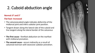2. Cuboid abduction angle
Normal: 0° and 5°
Flat foot- Increased
• The calcaneocuboid angle indicates deformity of the
midtarsal joint and infers subtalar joint position.
• Tangent drawn along the lateral side of the cuboid and
line tangent along the lateral border of the calcaneus
• The first cause - forefoot abduction on the rearfoot
with midtarsal pronation.
• The second cause - occurs indirectly as a result of
calcaneal eversion with excessive subtalar pronation.
 