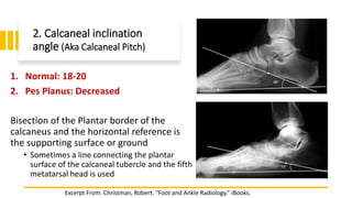 2. Calcaneal inclination
angle (Aka Calcaneal Pitch)
1. Normal: 18-20
2. Pes Planus: Decreased
Bisection of the Plantar border of the
calcaneus and the horizontal reference is
the supporting surface or ground
• Sometimes a line connecting the plantar
surface of the calcaneal tubercle and the fifth
metatarsal head is used
Excerpt From: Christman, Robert. “Foot and Ankle Radiology.” iBooks.
 