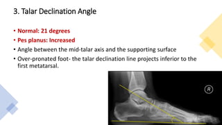 3. Talar Declination Angle
• Normal: 21 degrees
• Pes planus: Increased
• Angle between the mid-talar axis and the supporting surface
• Over-pronated foot- the talar declination line projects inferior to the
first metatarsal.
 