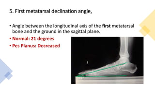 5. First metatarsal declination angle,
• Angle between the longitudinal axis of the first metatarsal
bone and the ground in the sagittal plane.
• Normal: 21 degrees
• Pes Planus: Decreased
 