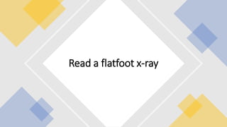Read a flatfoot x-ray
 