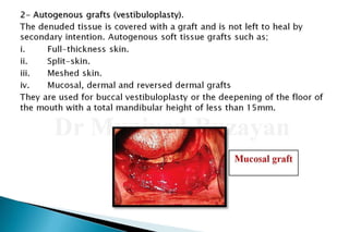 Flat ridge management