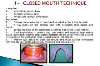 Flat ridge management