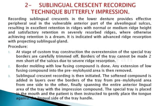 Flat ridge management
