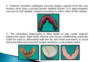 Flat ridge management